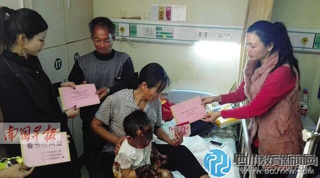 三岁幼童玩打火机 严重烧伤五岁姐姐